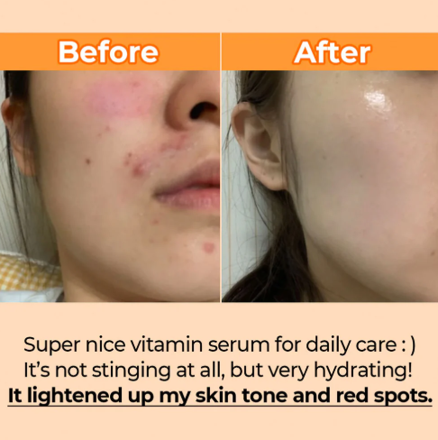 Numbuzin No.5 Goodbye Blemish Serum 50ml