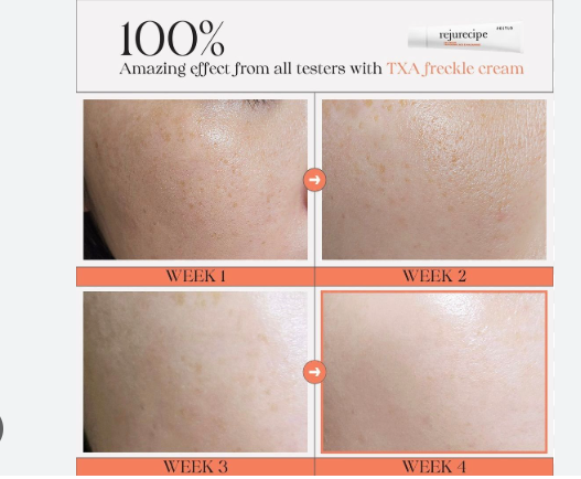 Pestlo Rejurecipe TXA Cream 30ml