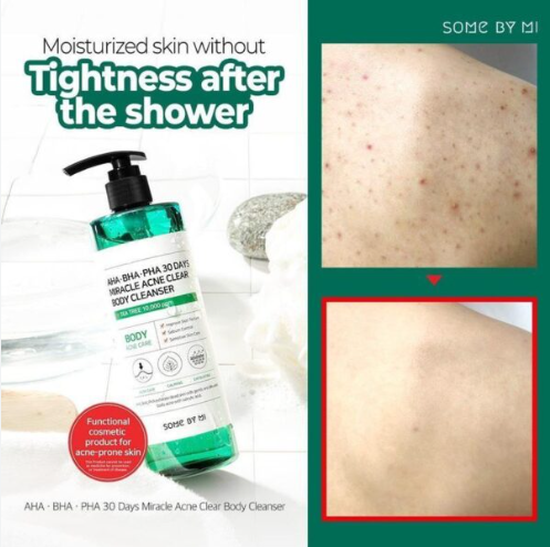 Some By Mi 30 Days AHA BHA PHA Miracle Acne Clear Body Cleanser 400g