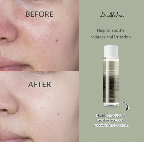 Dr.Althea Anastatica Skin Conditioning Toner 250ml